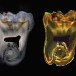 Un corso ECM sulla cariologia