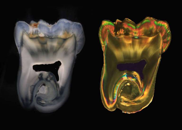 Un corso ECM sulla cariologia