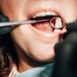 Valutazione CBCT dello stadio di ossificazione della sutura mesiopalatina DM_il dentista moderno_CBCT