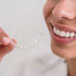 Indicazioni per scegliere le modalità della contenzione ortodontica DM_il dentista moderno_contenzione ortodontica