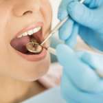 Matrici biomimetiche in associazione con CAF nella copertura di recessioni lievi-moderate DM_il dentista moderno_controllo_visita_valutazione parodontale_recessioni radicolari_copertura di recessioni
