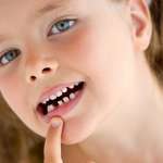 Esiti a lungo termine di traumi dei decidui sulla dentatura permanente