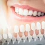 Il colore in odontoiatria estetica: percezione e strumenti di standardizzazione