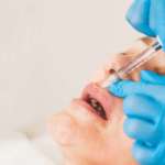 L’utilizzo di filler a completamento di una terapia protesica