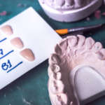 Disilicato di litio: la traslucenza può influenzare la polimerizzazione dei cementi resinosi? DM_il-dentista-moderno-disilicato.jpg