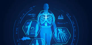 SPECT-CT nella valutazione dell’osteonecrosi da bifosfonati DM_il dentista moderno_bifosfonati_denosumab