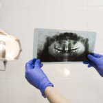 Criteri radiografici nella valutazione del seno mascellare DM_il-dentista-moderno_radiografia_seno-mascellare.jpg