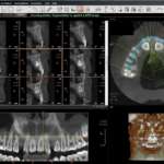 L’ortognatodonzia 4.0 in un corso Fad
