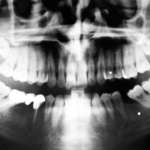 Medicina manuale nei disordini temporomandibolari: opportunità della moderna gnatologia