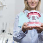 Crescita scheletrica e profilo del volto nel soggetto con II classe scheletrica DM_il dentista moderno_II classe scheletrica