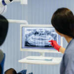 Trazione extraorale nel trattamento della II classe DM_il-dentista-moderno_trazione-extraorale.jpg