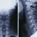 Un’artrosi di natura professionale