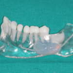 Ruolo della stampa 3D in fase diagnostica e nella preparazione chirurgica dei casi complessi