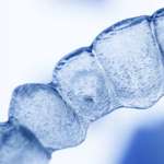 La terapia con allineatori nei casi ortodontici complessi