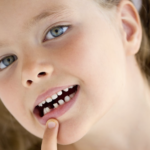 Analisi di sopravvivenza del dente avulso e reimpiantato