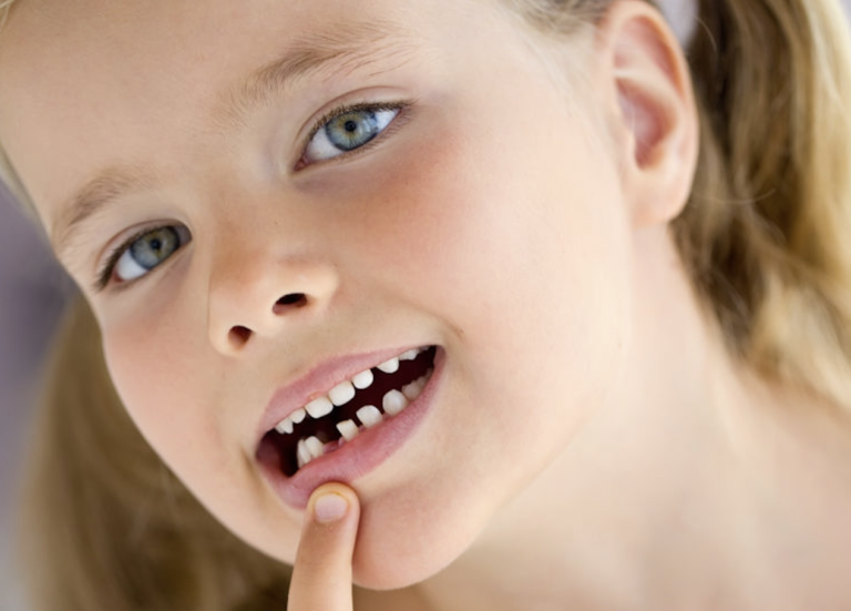 Analisi di sopravvivenza del dente avulso e trapiantato