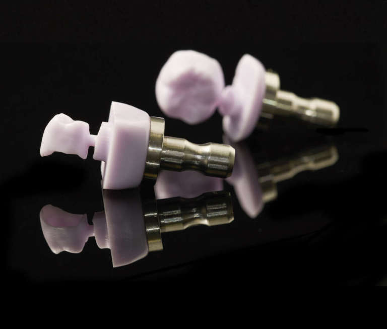 I restauri con intarsio: quali vantaggi?