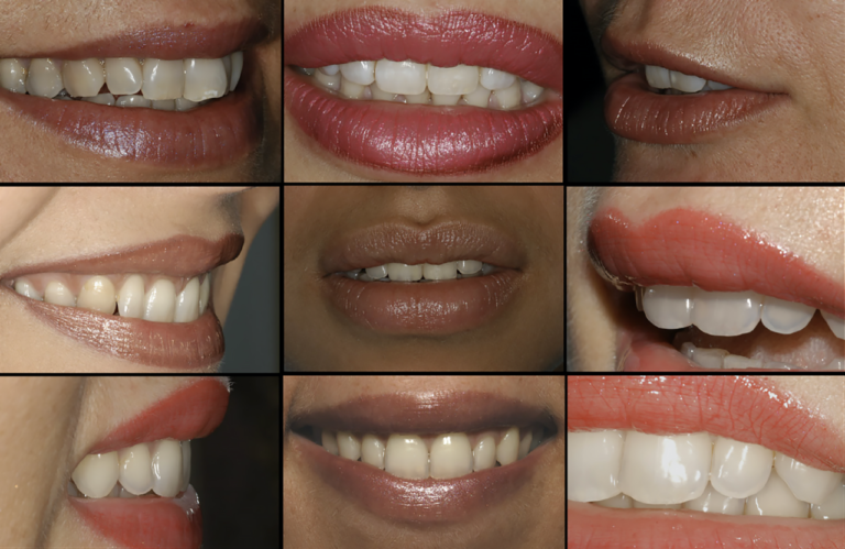 Integrazione biologica, estetica e funzionale  in protesi fissa attuali orientamenti