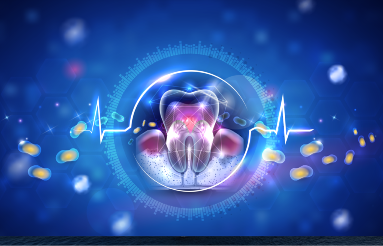 Parodontite e aterogenesi: un legame sempre più evidente