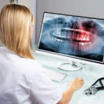 La radioprotezione dal principio ALARA ad ALADAIP