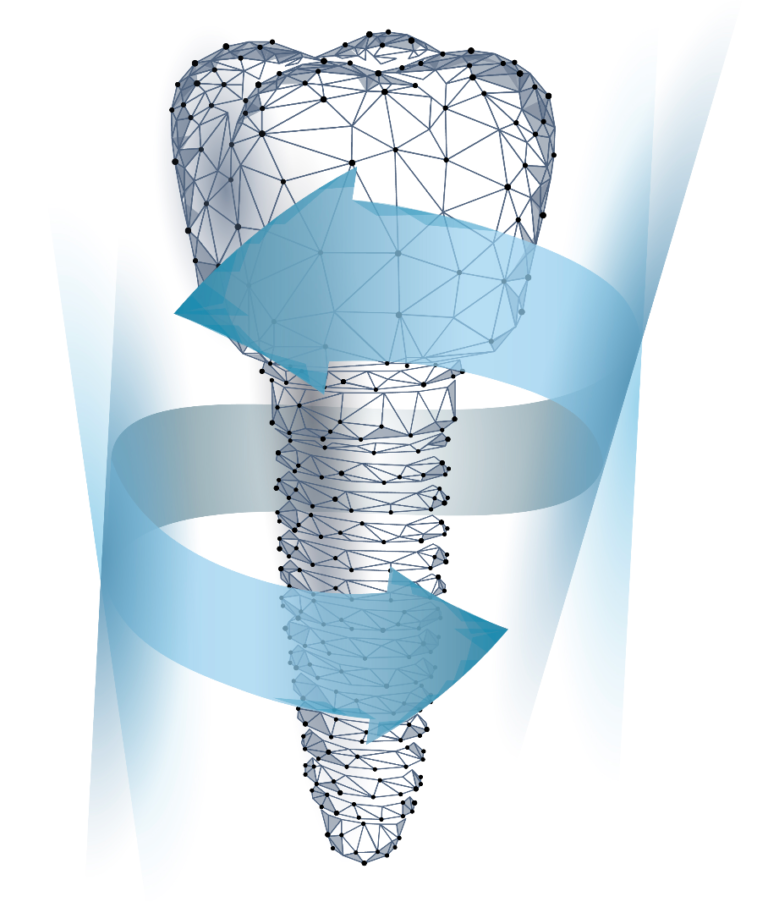 Riabilitazione implantare Full Arch con sistema “All on 6” : una serie di casi