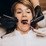 Recessioni gengivali: lembo avanzato coronalmente, tunnel technique; connective tissue graft e derivati di matrice dello smalto DM_il-dentista-moderno_recessioni-gengivali.jpg