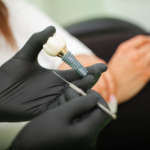 Verso un nuovo modello eziopatogenetico e terapeutico per la perimplantite DM_il-dentista-moderno_La-posizione-dell’impianto-è-un-fattore-di-rischio-per-la-perimplantite.jpg