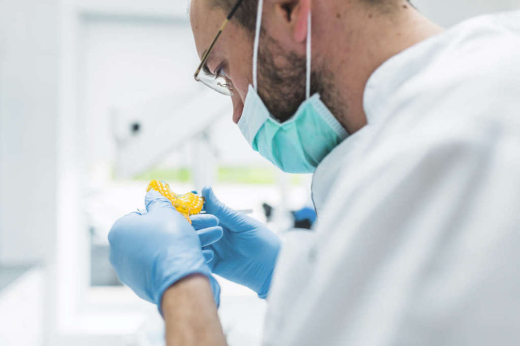 DM_il dentista moderno_Tecnica mista analogico-digitale nella rilevazione dell’impronta di precisione