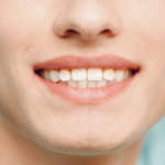 L’estetica nella riabilitazione implantare Implantologia immediata in regione estetica: provvisorizzazione immediata o ritardata