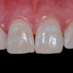 Global Clinical Case Contest 2019-2020, i premiati