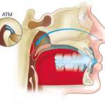 La malocclusione dento-scheletrica nella patogenesi dei disordini temporomandibolari