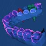 Il sistema ortodontico ”Made in Italy” che sfrutta la forza dei magneti