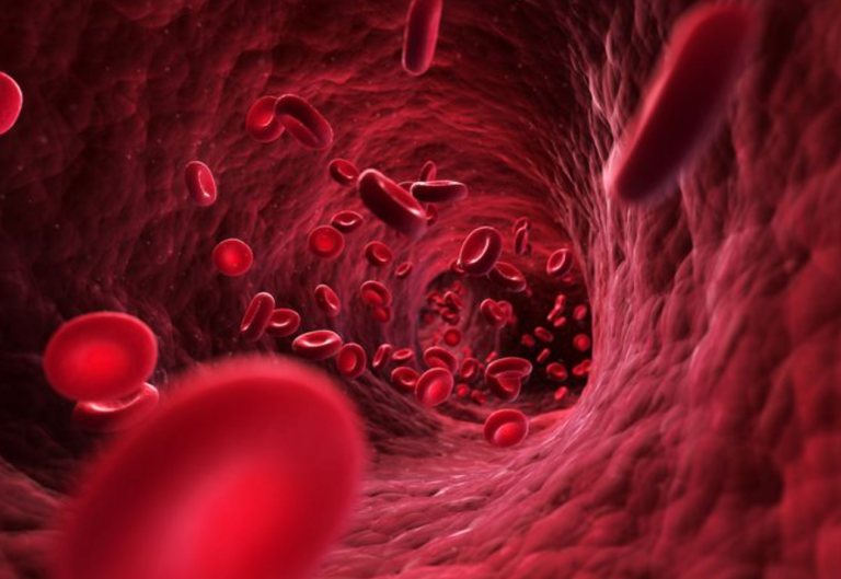 Esiste un’associazione tra parodontite e ipertensione arteriosa?