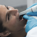 Accuratezza dell’impronta digitale con scanpeg in implantoprotesi