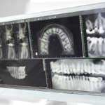 Imaging in odontoiatria: tridimensionale e sempre più accurato