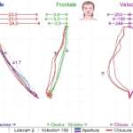 Tmd-relief: studio clinico di efficacia nei pazienti con dolore miofasciale