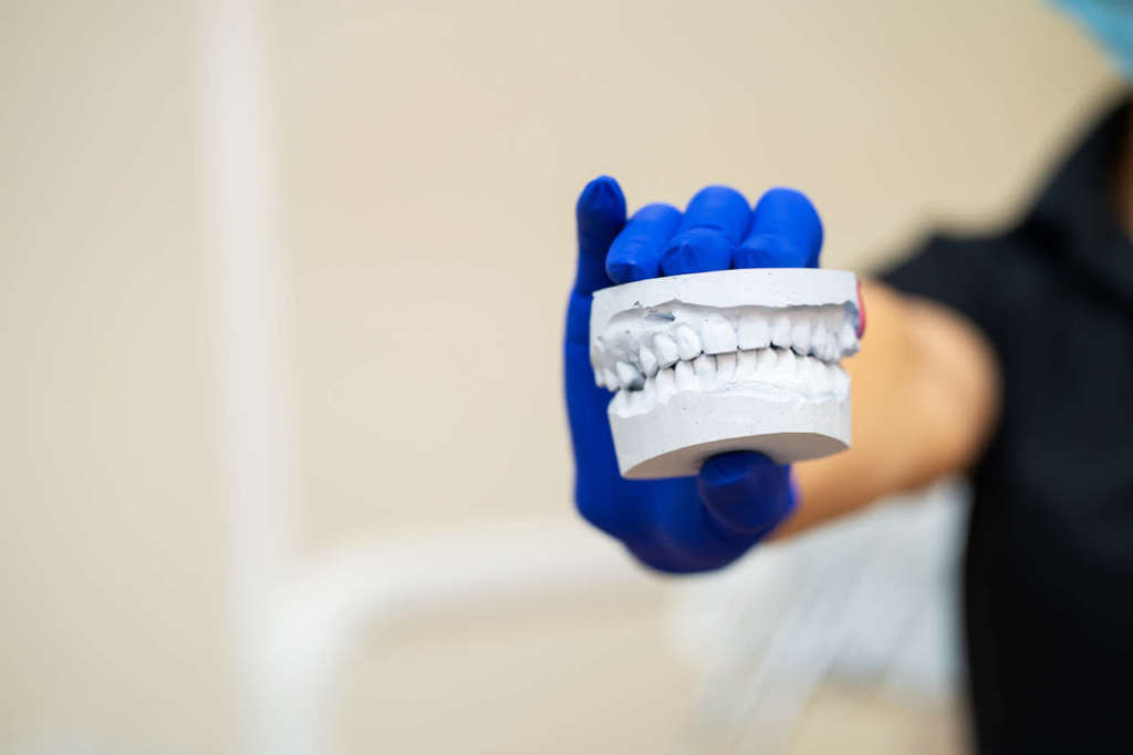 DM_IL DENTISTA MODERNO_scanner intraorale