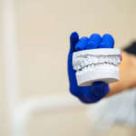 Scanner intraorali in caso di edentulia e riabilitazione con protesi totali DM_IL DENTISTA MODERNO_scanner intraorale