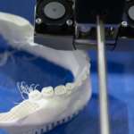 Stampante 3D: applicazioni cliniche in odontoiatria
