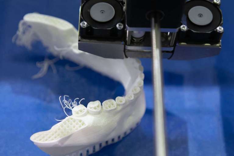 Stampante 3D: applicazioni cliniche in odontoiatria