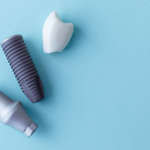 Stabilità implantare in relazione alla qualità ossea Dm_il dentista moderno_superfici implantari