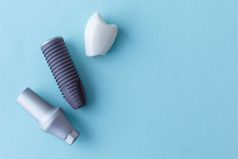 Debridement ultrasonico delle superfici implantari