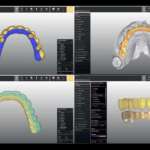 Il workflow digitale nel carico immediato