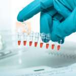 Test per lo screening della salute parodontale