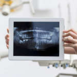 Influenza della dispersione sulla qualità della TC cone beam