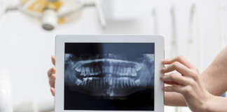 Influenza della dispersione sulla qualità della TC cone beam