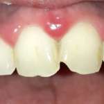 Igiene orale nel paziente con patologie sistemiche