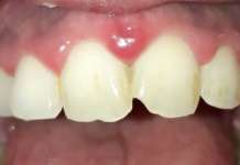 Igiene orale nel paziente con patologie sistemiche