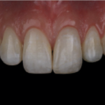 I vincitori dell’edizione italiana del Global Clinical Case Contest 2020/2021