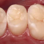 I vincitori del Global Clinical Case Contest 2020/2021